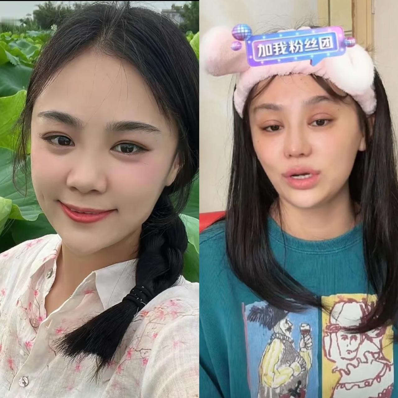 终于明白樊小慧为什么会去整容了，不是因为以前长得不好看，也不是因为容貌焦