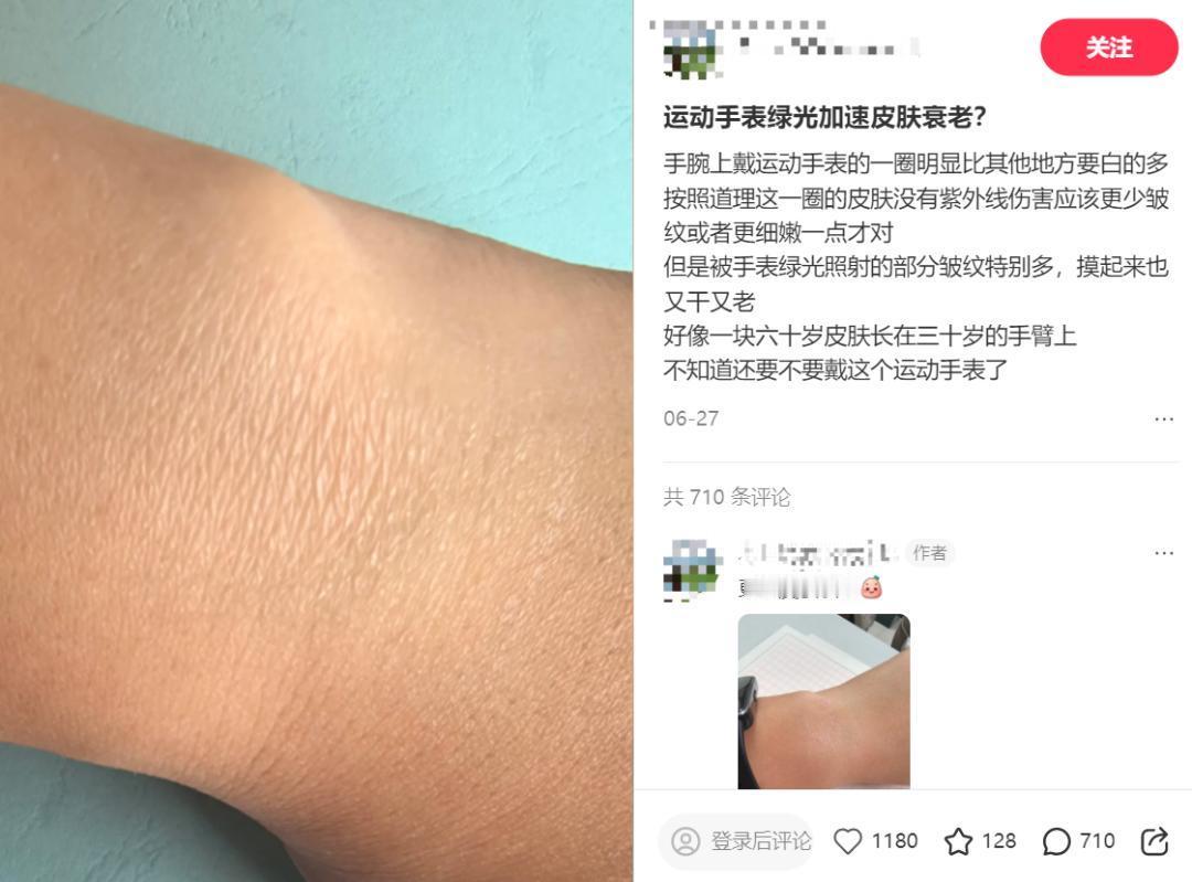 第一批戴运动手环的“受害者”出现，不少人24小时不离手，手腕闷出一圈病态白印。