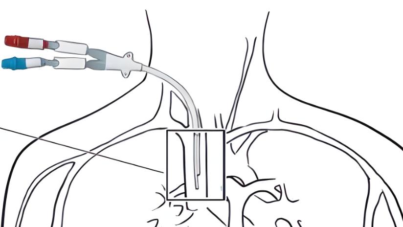 化疗药口服和静脉注射有什么不同？在癌症治疗中如何选择？“殷主任，同样是化疗，