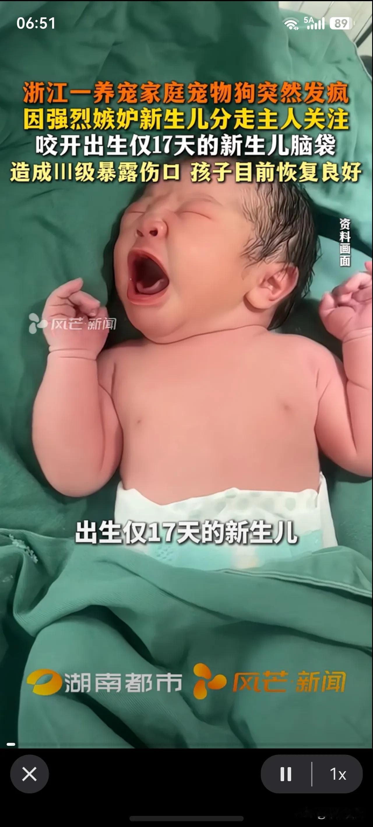 养了多年的宠物狗和新生儿哪个更重要？近日杭州一户人家发生惊险一幕：出生仅1