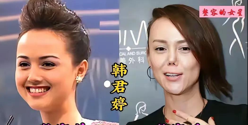 千万别随意去整容！千万别随意去整容！如果你不怕，你看看韩君婷，她整容堪称毁容