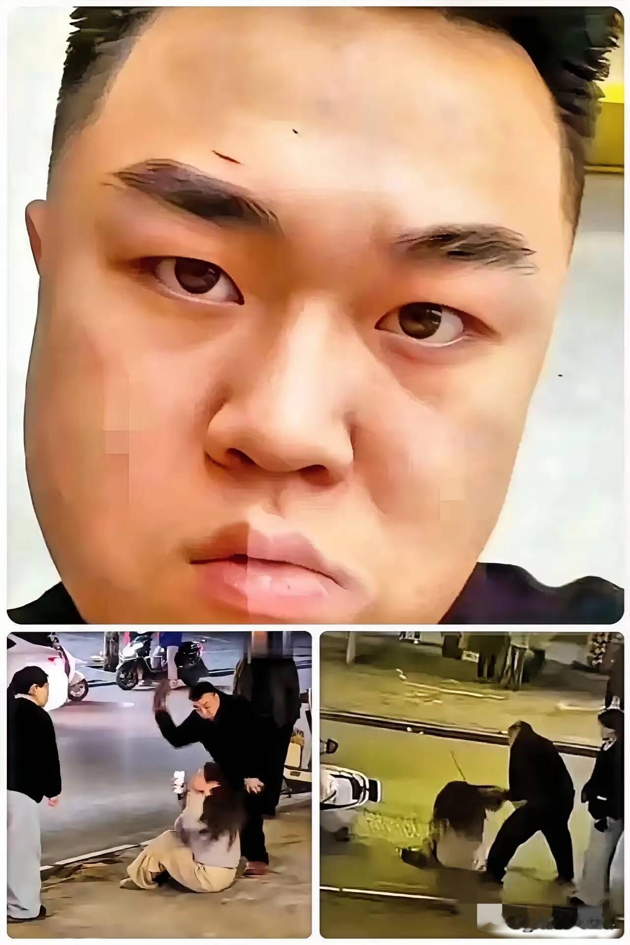 听说了吗？那对打人的两口子现在急眼了，到处托人想找小姑娘一家私了。我真是听乐了，