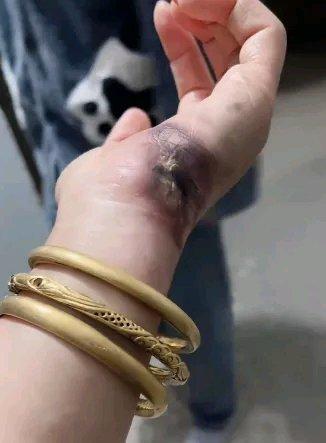 安徽宿州的刘女士可真是倒霉透顶了。10月25日,她给淋了雨的电动车充电,掰开充电