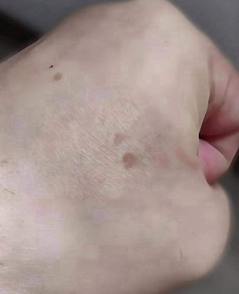 我突然发现我的手上有了这种斑点，看着很别扭，我用香皂仔细摸了好几遍，还是洗不下去