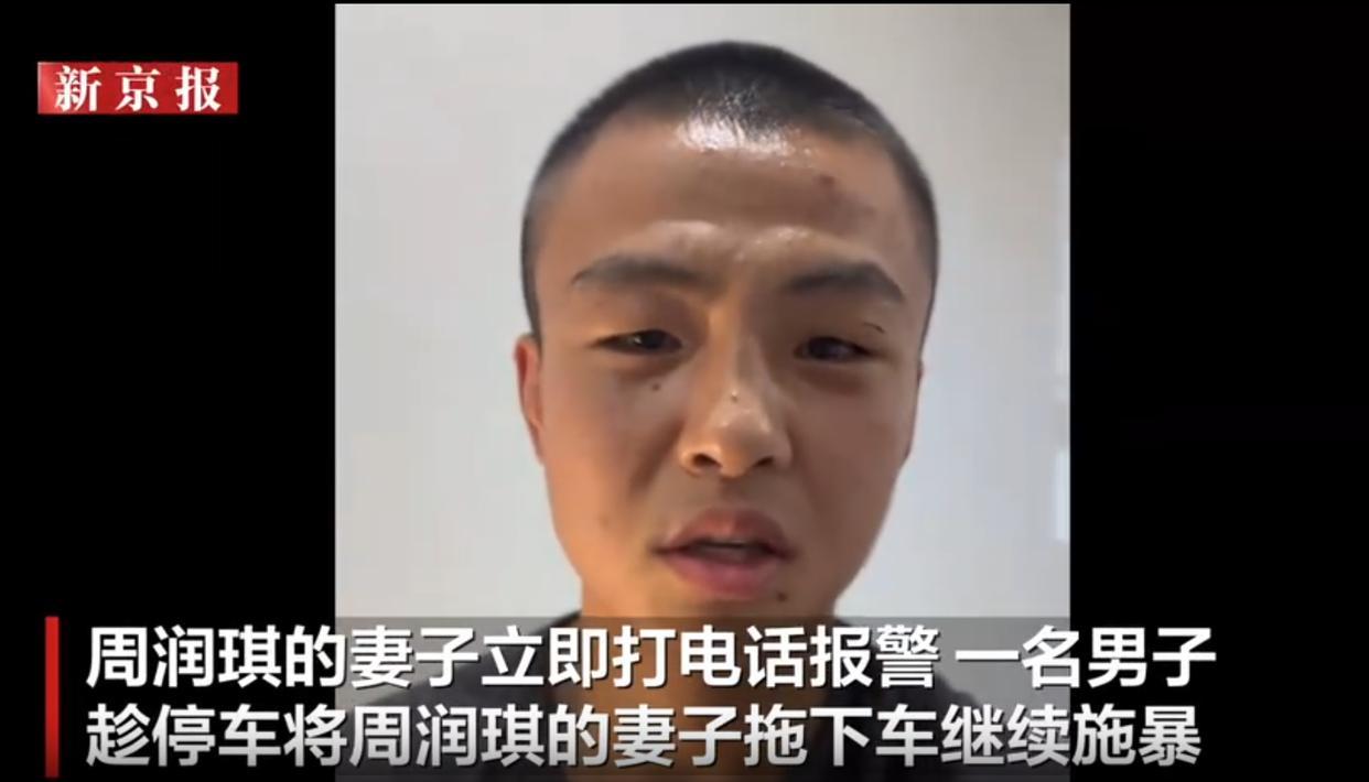 拳王周润琪被打了，后脑勺被改锥之类的物品扎的很深的伤口。周润琪与他妻子在澳大