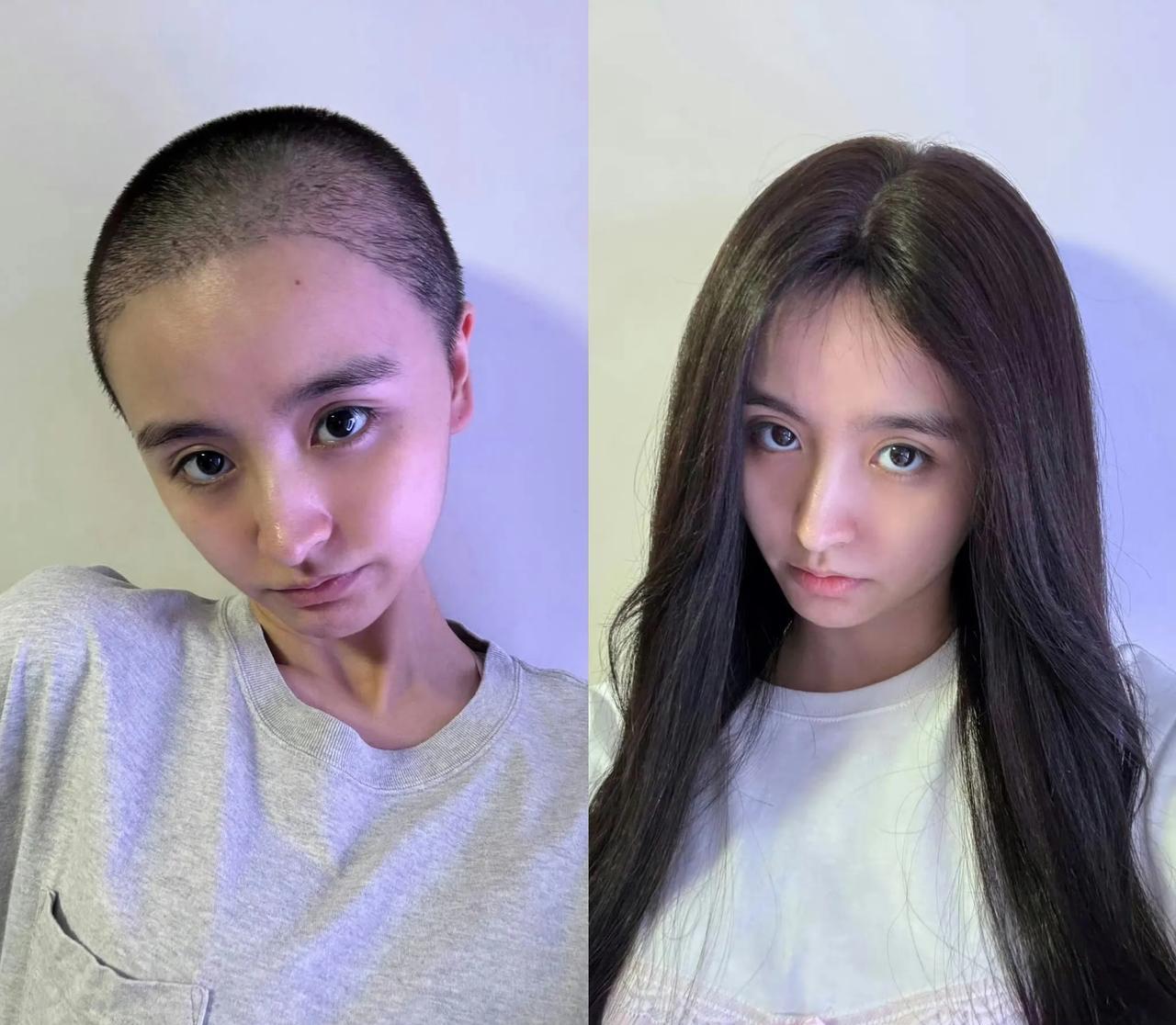 女爱豆退圈后，剃了光头，娱乐圈的压力不是一般的大呀[哭哭]金子涵，年轻漂亮