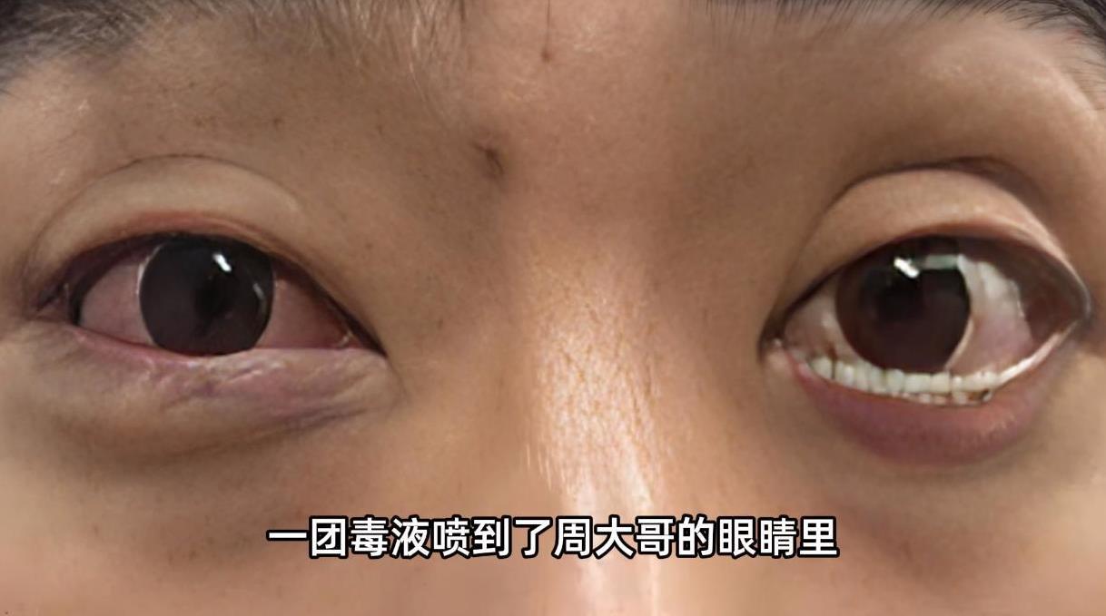 “这下后悔了吧！”近日，浙江杭州，一男子在户外爬山的时候，突然遇到了一条1米多长