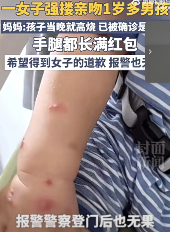 警惕！小区里的“甜蜜陷阱”，一吻竟让孩子高烧染病 看到这个新闻我真的气炸了！