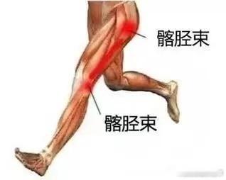 膝盖疼痛【膝痛康复】膝盖侧面总是不舒服，可能有哪些损伤风险，来帮你详细分析👇