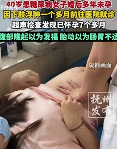 “解释不清了！”浙江，40岁女子连续几月不来“大姨妈”！她以为自己停经了，直到下