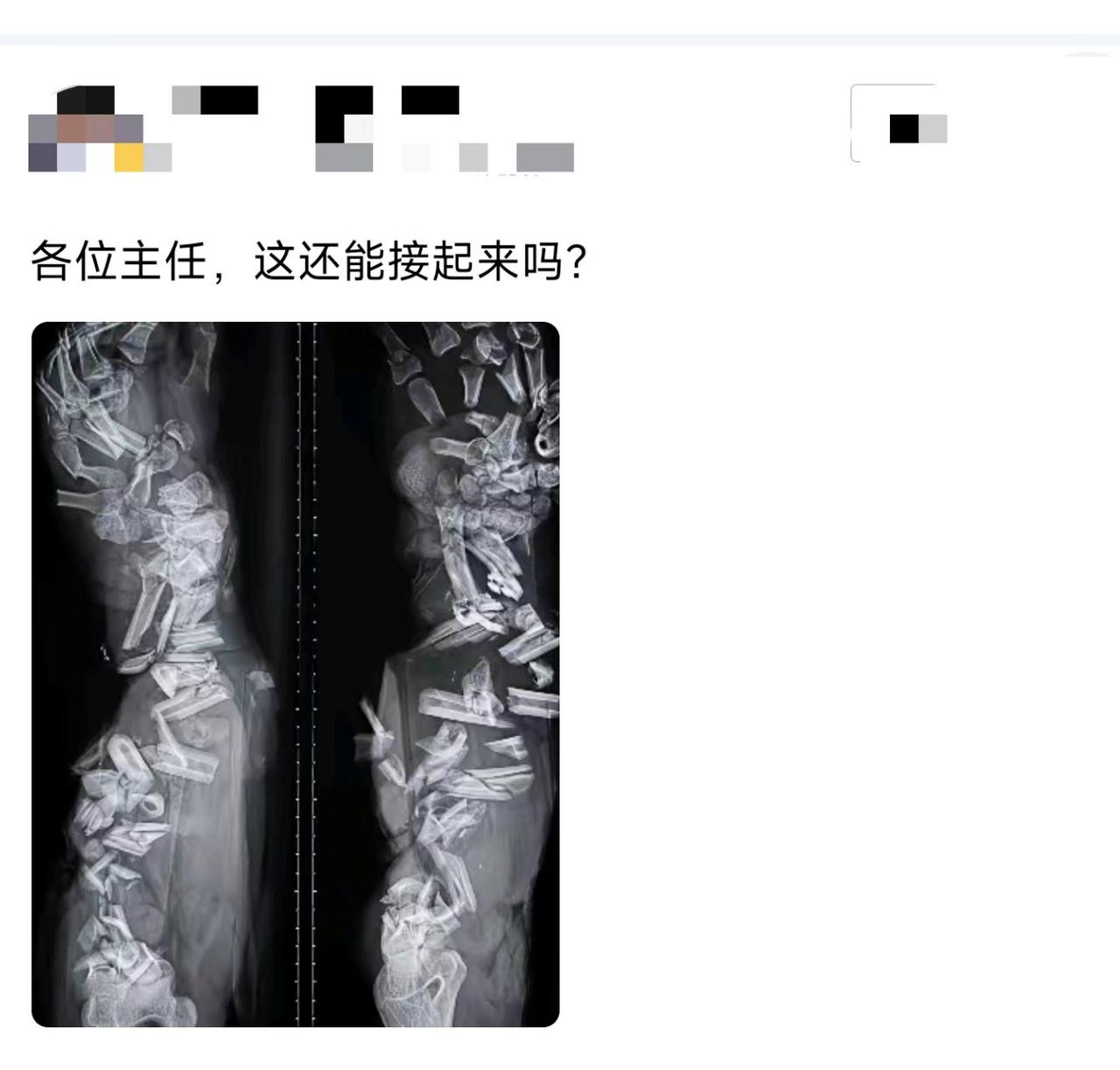 医生看了都得先抽根烟压压惊。[捂脸哭]