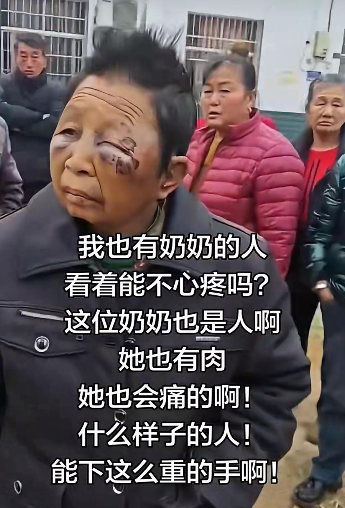 这个老太叫陈光明，可是她的眼睛却要被75岁的老伴打瞎了。他们住在湖南平江梅仙镇百