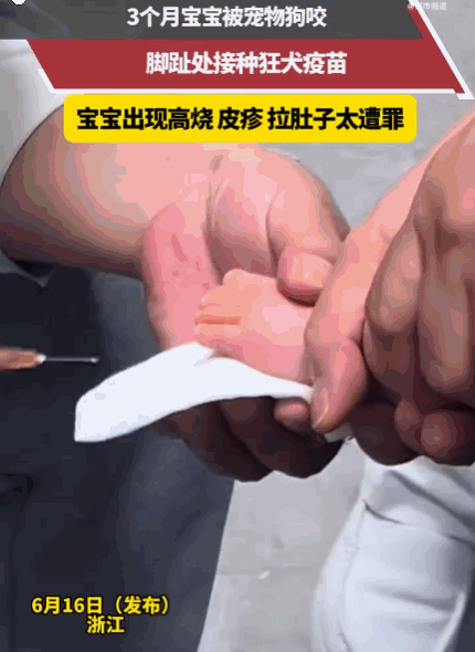 防不胜防！6月17日报道浙江，一个才3个月的宝宝正乖乖喝奶，被邻居突然冲过来的狗
