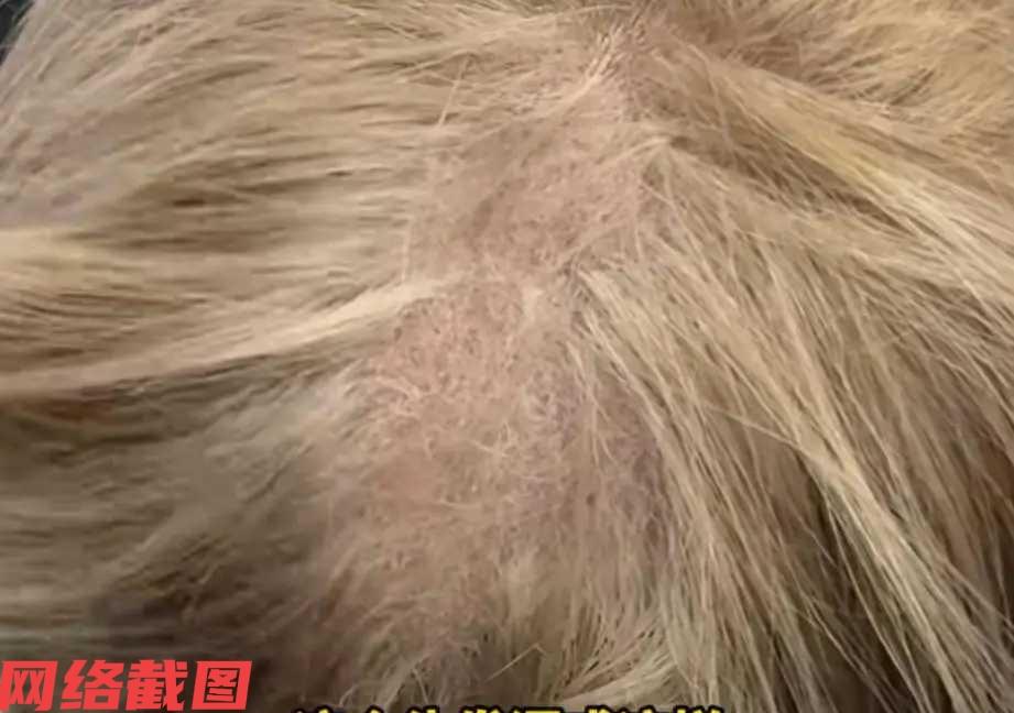 上海有女子在一家理发店要求染发。只是这家店的理发师检查到女子的头皮时，发现女