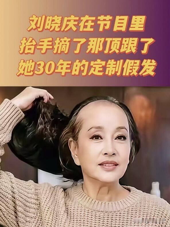 刘晓庆摘假发这事，之前好多人夸她勇敢、真实，但我觉得根本谈不上勇不勇敢，她单纯就