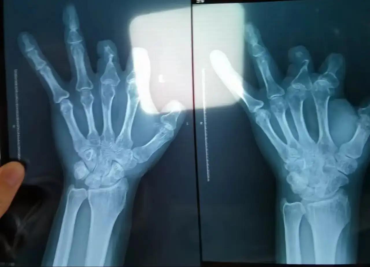 这件事，简直像是一部令人毛骨悚然的黑暗剧本，却真实发生在我们身边。94个无辜的患