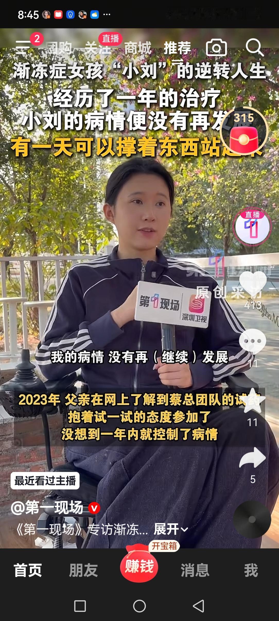 蔡磊的医学团队太厉害了，竟然攻克了渐冻症这道医学难题！渐冻症姑娘小刘是不幸的，