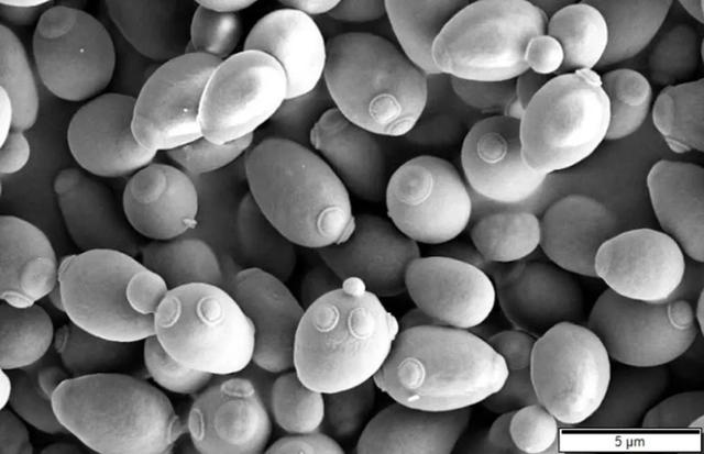 酿酒酵母在电子显微镜下的照片.图片来源:wikipedia