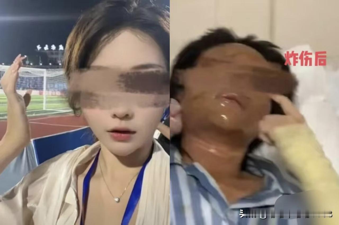 现在最难受的就是湖南这个收到陌生快递被炸伤的女主播了！最可怕的是这个快递女主