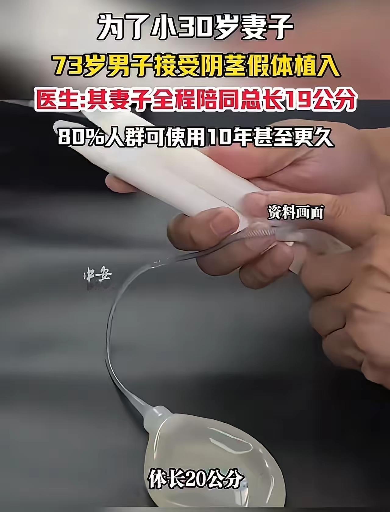 不得不说，这位大爷活得实在通透！湖北一位73岁的老人，为了和比自己小30多岁的妻