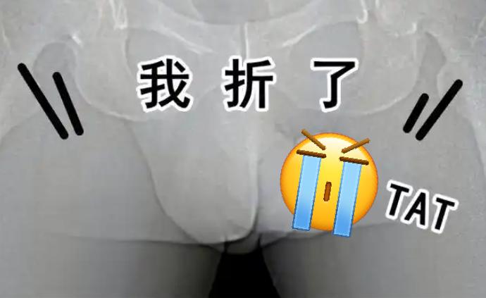 “太悲催了！”浙江一对夫妻小别胜新婚，丈夫迫不及待和妻子亲热。不料，丈夫用力过猛
