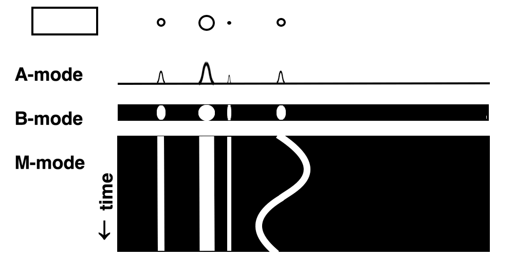 运动康复刚刚提到了超声，想起之前一个提问：既然有B超检查，那有没有A超或者C超