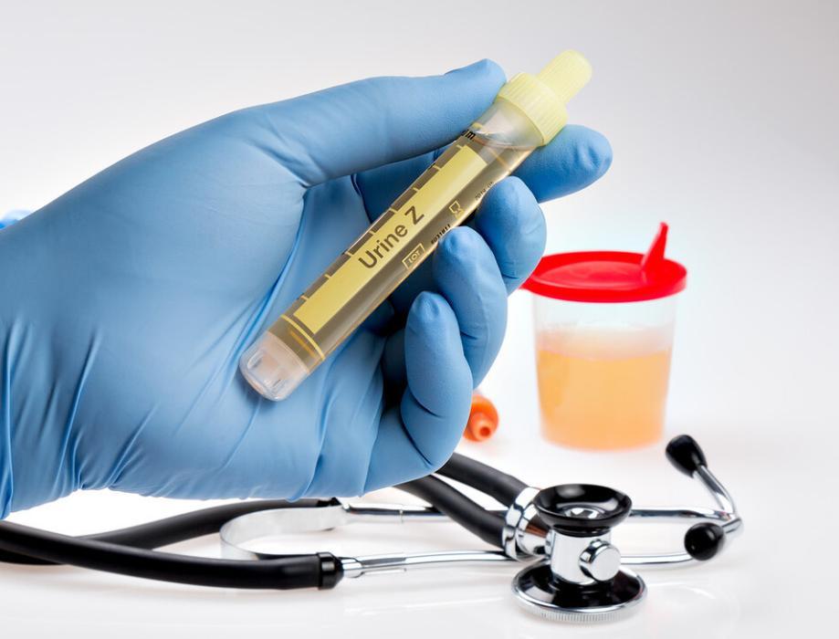 男性晨起后，若第一泡尿有3个特征，说明肾脏可能还蛮强壮早上起床第一件事，很多