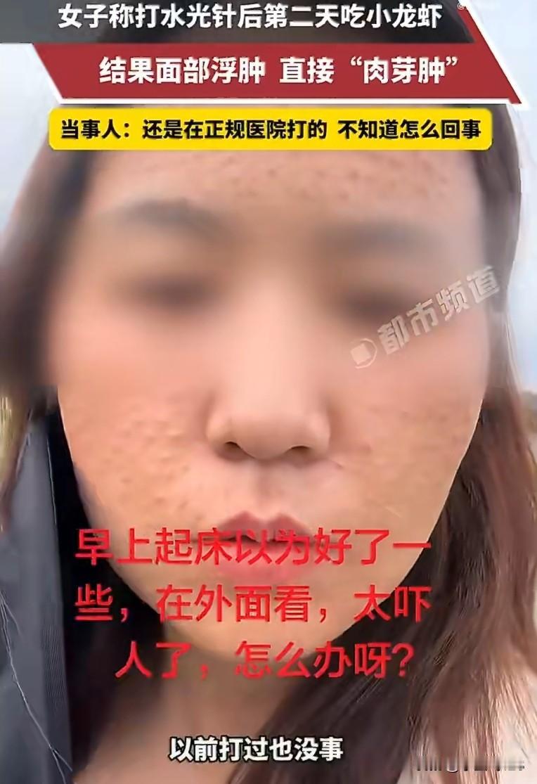 打完水光针第二天就吃小龙虾，结果满脸肉芽肿——这哪是变美，这是作死。四川这位