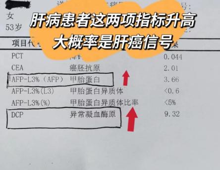 警惕这2个指标异常，多是肝癌发出的警报！作为一名肝病医生，最让我揪心的就是有些
