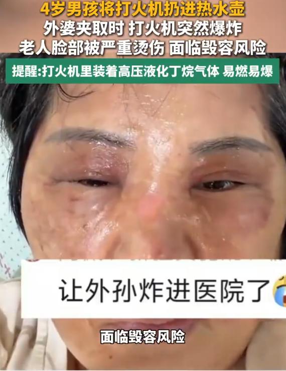 “真的看得人心里发紧！”浙江湖州，一名4岁男孩趁大人不注意，将打火机扔进了刚烧开