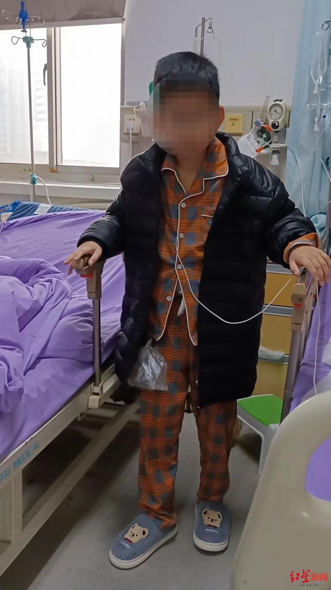 山东菏泽11岁男孩小烨因课间被撞腹痛就医，成武县人民医院手术切除其十二指肠、胰腺