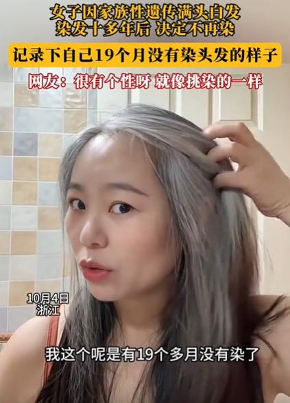 浙江一女子发现几根白发，她本以为拔了就是！万万没想到，仅仅几个月时间，她原本光亮