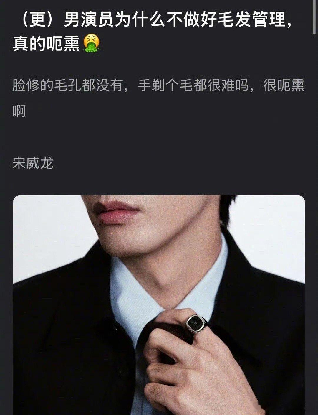 宋威龙今日活动被网友发现不注重毛发管理