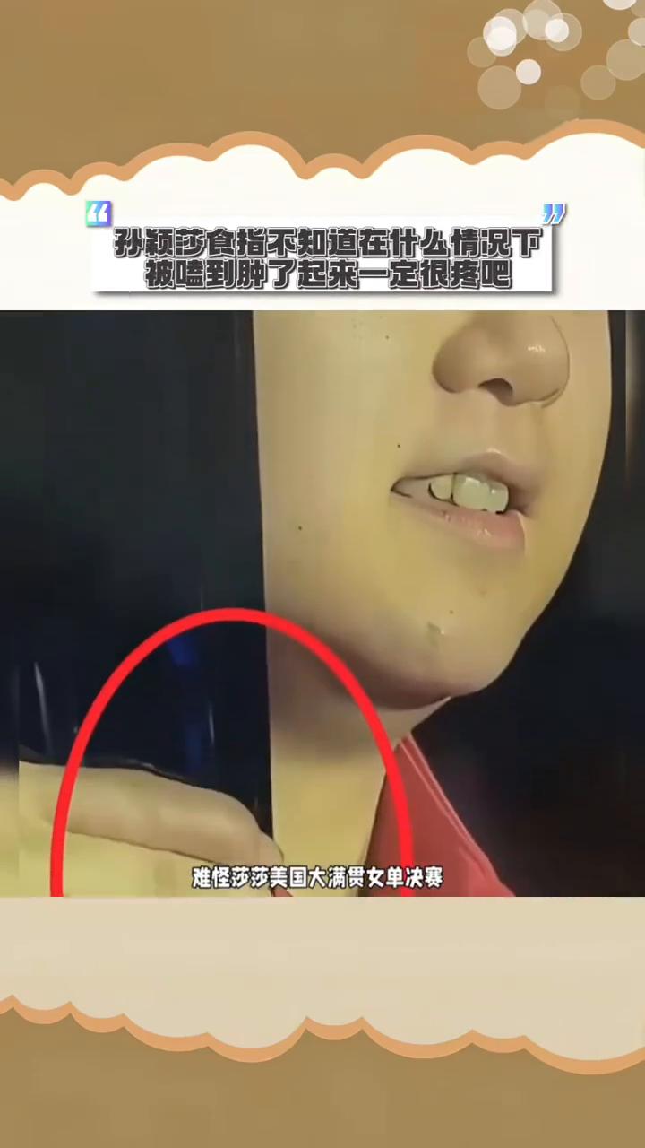 孙颖莎食指不知道在什么情况下被嗑到肿了起来，一定很疼吧。难怪莎莎美国大满贯女单