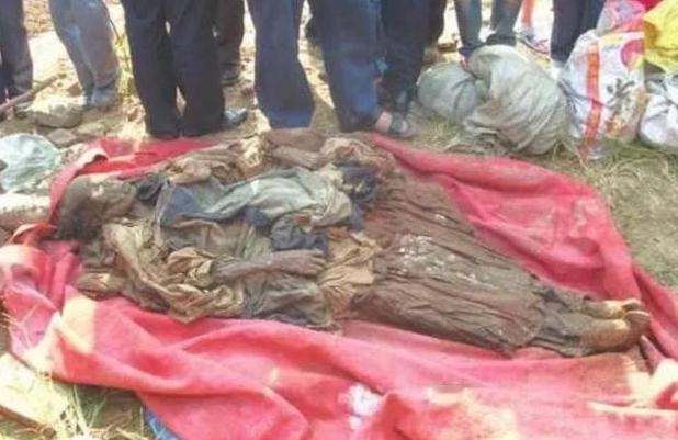 1988年，江西出土的一具女尸，当褪下她的衣服时，发现女尸的身体下面有一团肉块，