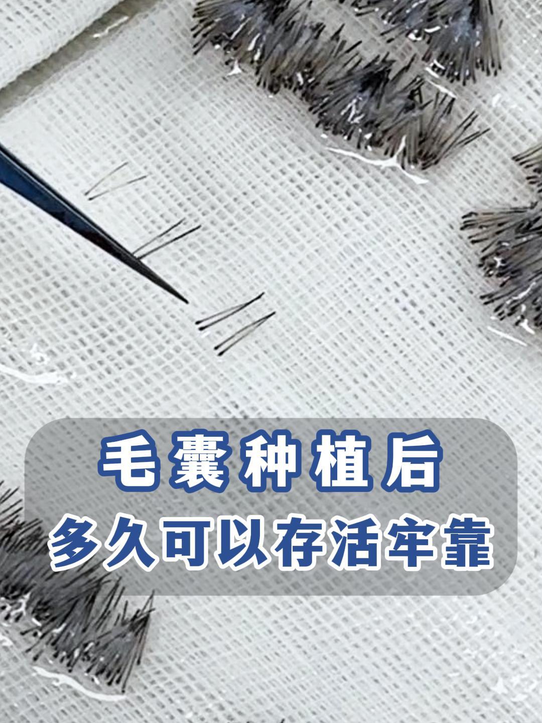 毛囊种植后多久可以存活？。1.多久可以存活      种植的毛囊在肿胀...