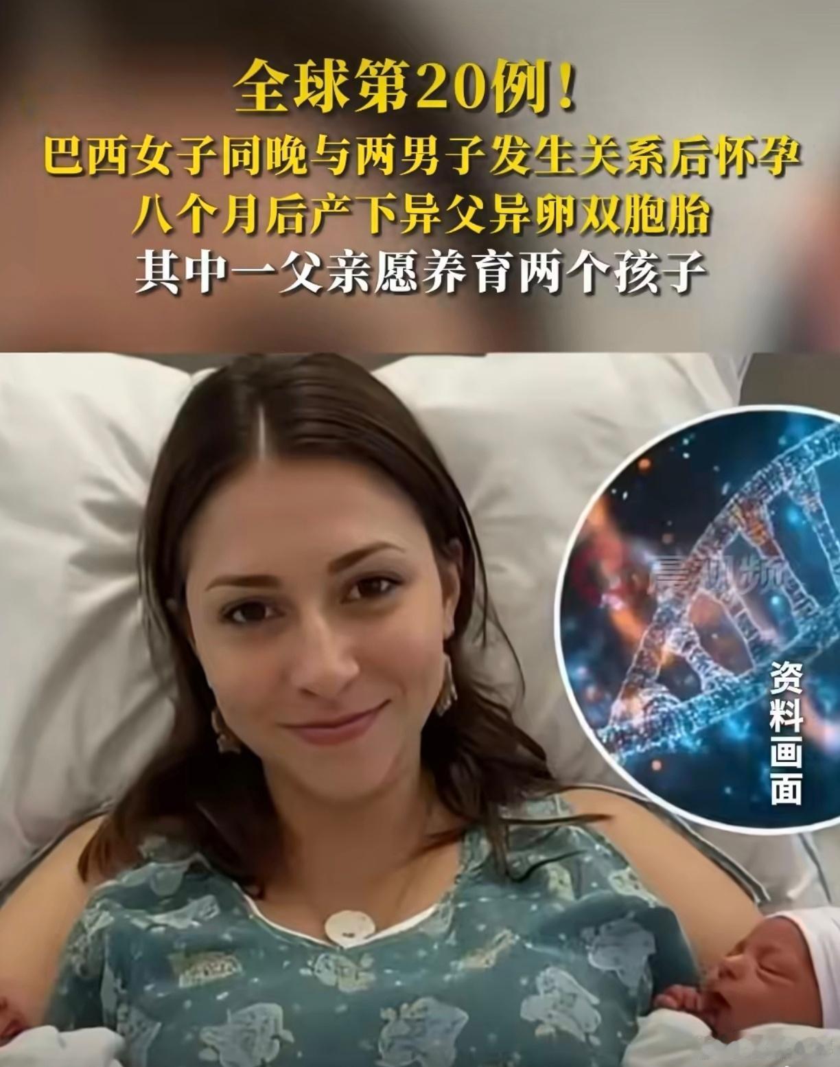 巴西一女子产下双胞胎，孩子父亲却不同，这可是全球罕见的“异父异卵超受精”案例，至