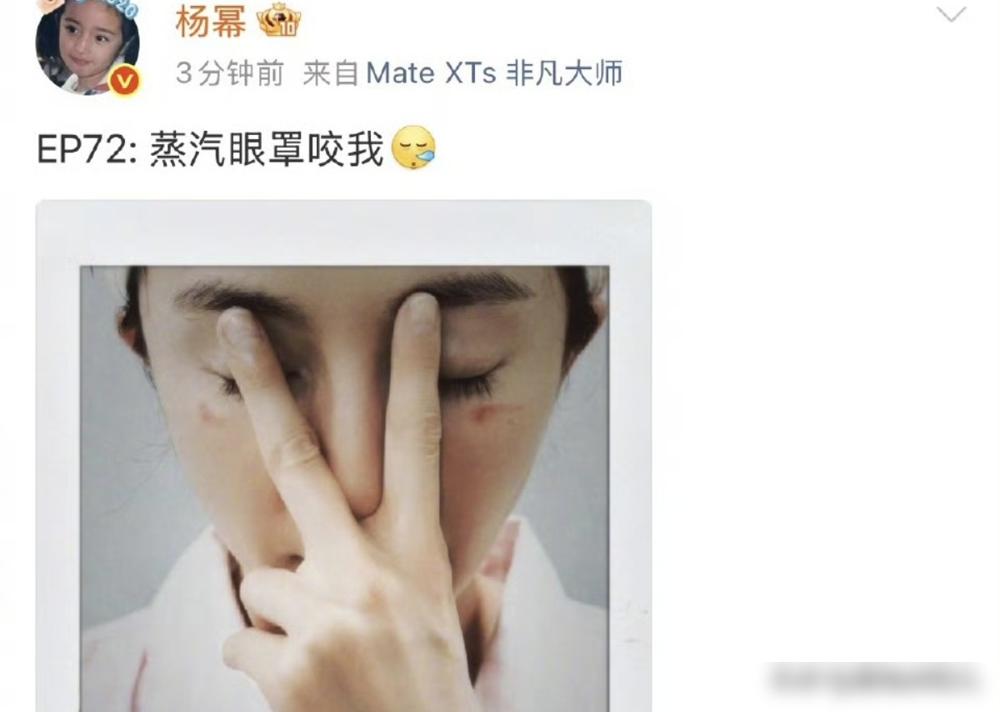 一张蒸汽眼罩，撕开了杨幂顶流女王的伪装，你看到的不是伤疤，是她绷了十几年的那根弦