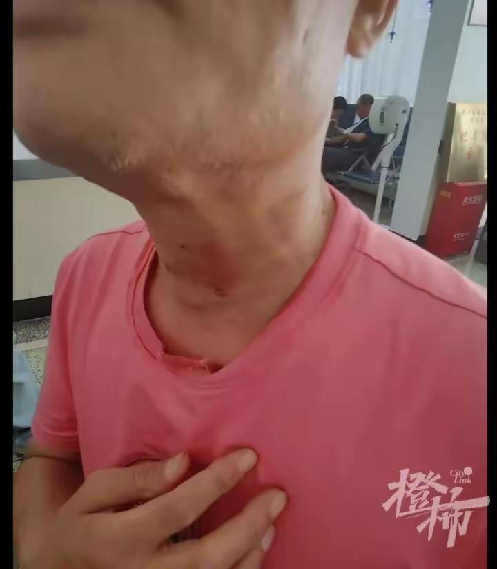 现实版的农夫与蛇：浙江，6旬大叔好心解救大蛇，却被大蛇瞬间锁喉。最后大叔只能一点
