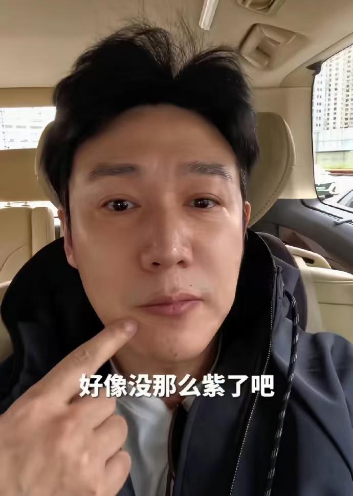 50岁的陆毅，被网友“逼”进医院了！张雪峰因心源性猝死去世，引发很多人对嘴唇