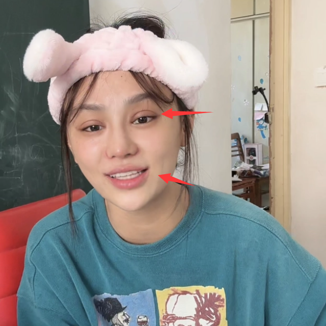 网红<em>樊小慧</em>为变美而整容，自曝前夫2年没碰她，才发现对方已出轨