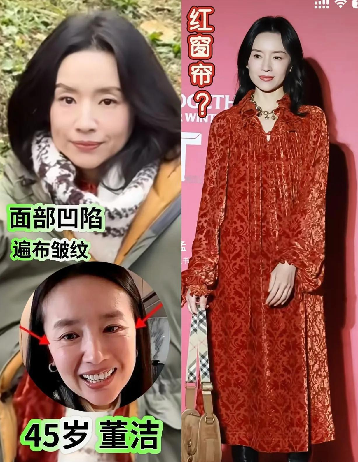董洁的45岁：是垮了还是活透了？刷到董洁近况，有人说她面部凹陷显老、红裙像