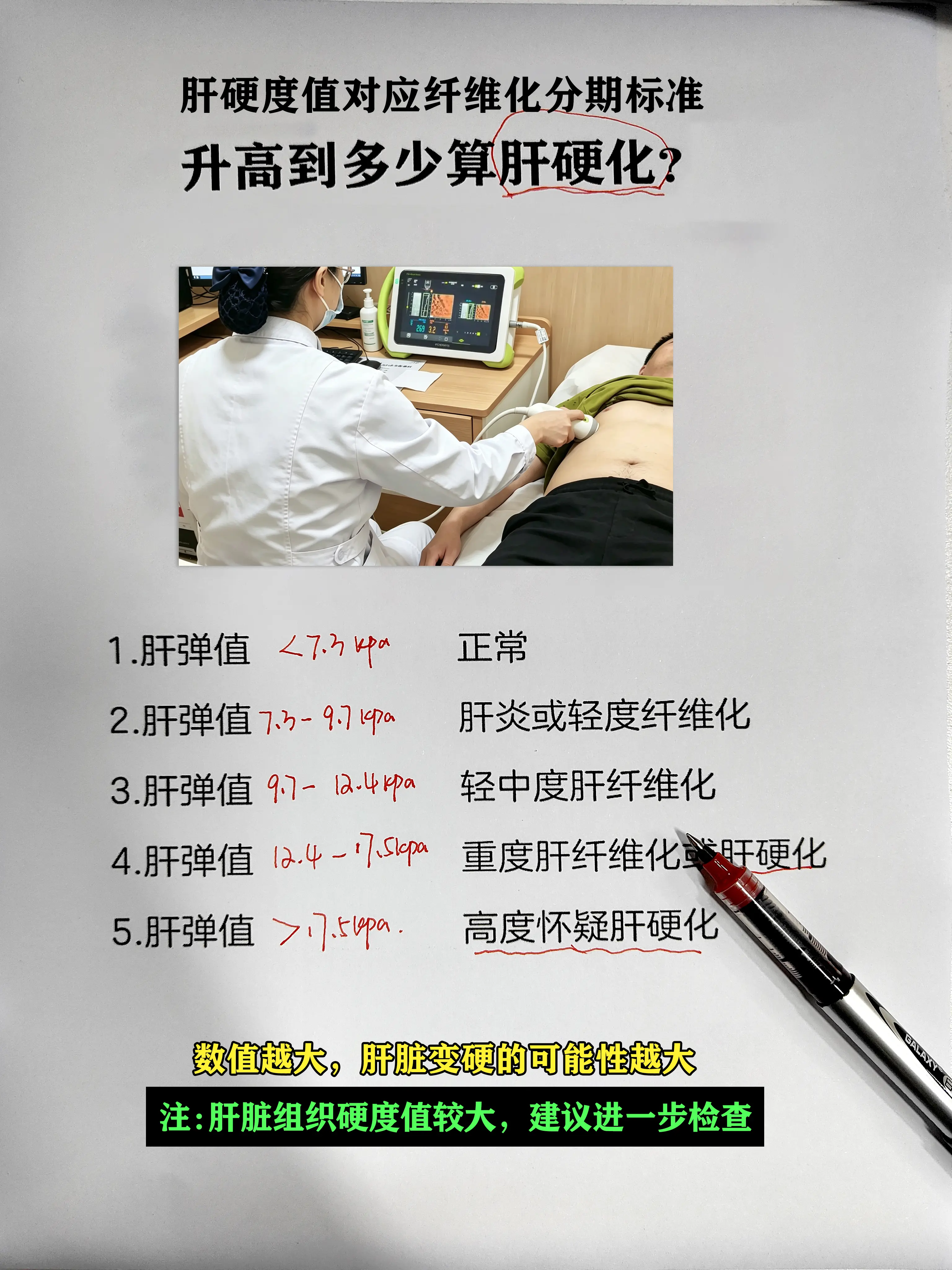 乙肝 肝硬化 肝弹 健康科普 山东肝病医生吴龙奇