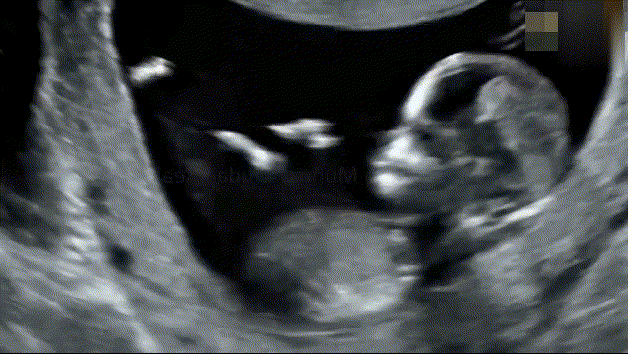 宝宝每天在妈妈的肚子里做什么[思考]？做得最多的：睡觉胎儿在妈妈肚子里都