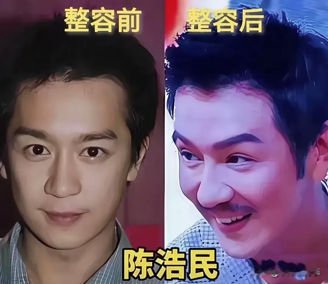 苏有朋、刘恺威、陈浩民、吴刚：这4位男明星整容前后，有人认不出来。刘恺威从单