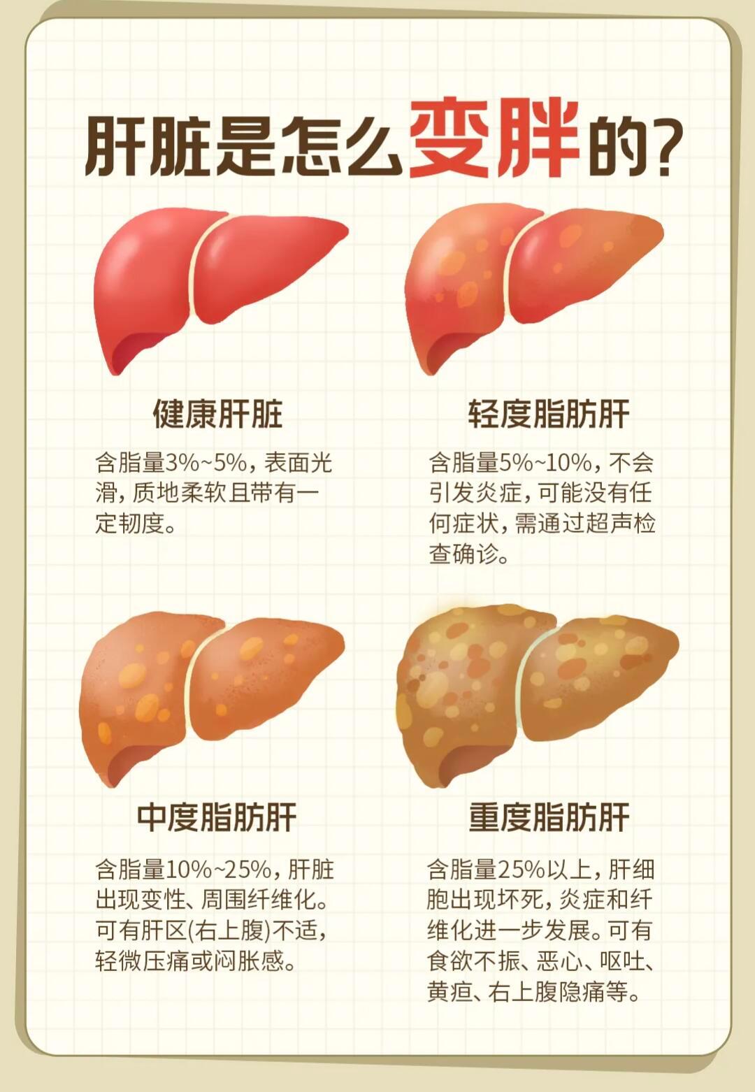 体检报告上的脂肪肝离肝炎有多远体检查出脂肪肝别慌！轻度可逆，重度危险拿到体检报告