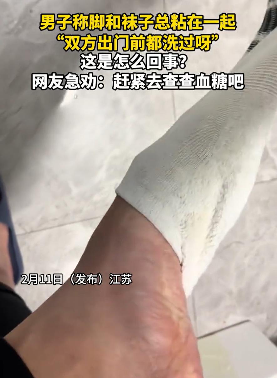这下解释不清了！江苏，一男子发视频求助，自己的脚和袜子总是粘在一起，可自己出门前