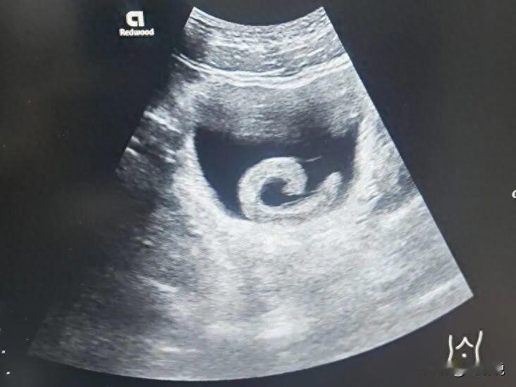 是个狠人！河南郑州，一名23岁的小伙子，因为好奇心和一点猎奇心理，做了一件令人难