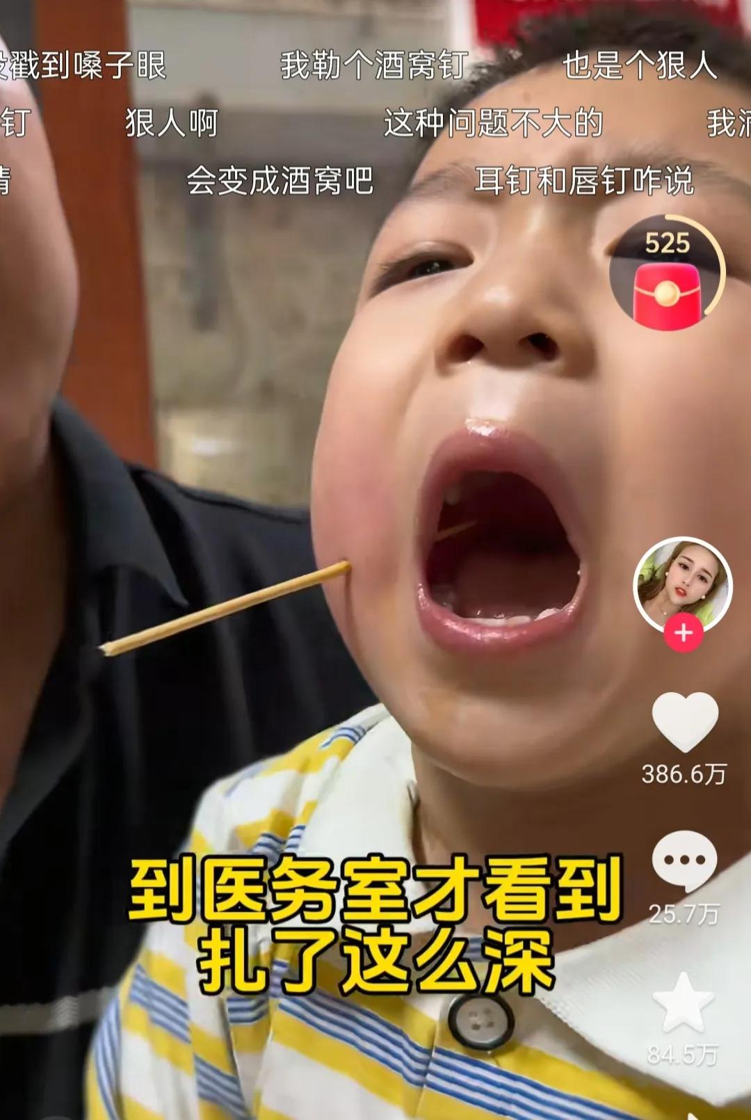 揭秘：西双版纳“竹签穿脸”事件，不是玩梗是惊魂，儿童意外伤害藏致命隐患这则