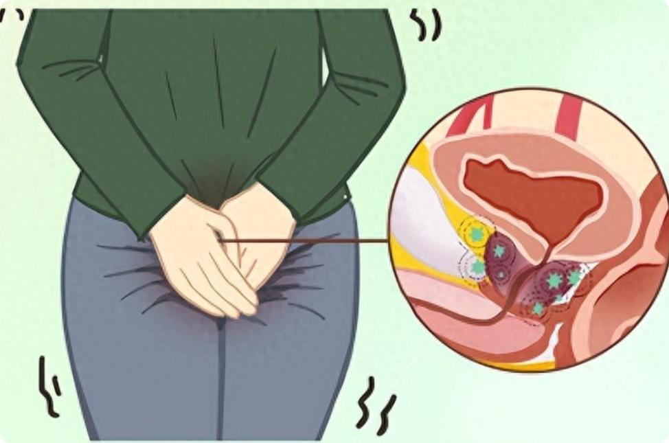 肾气一虚，尿频难止！千古良方温肾阳、固膀胱，告别一夜起夜十几次我是中医陈大夫，